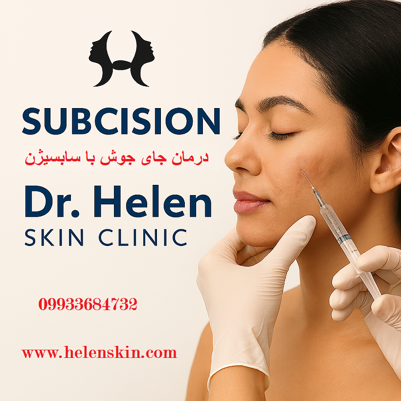 <figure> <img src="https://helenskin.com/images/subcision-treatment.jpg" alt="سابسیژن برای درمان اسکارهای فرورفته ناشی از آکنه در کلینیک دکتر هلن" title="سابسیژن: درمان تخصصی جای جوش و اسکارهای آتروفیک" loading="lazy" width="600" height="400" /> <figcaption> مراحل درمان اسکارهای آکنه با تکنیک سابسیژن در کلینیک پوست و زیبایی دکتر هلن. </figcaption> </figure> <!-- داده‌های ساخت‌یافته برای تصویر (JSON-LD) --> <script type="application/ld+json"> { "@context": "https://schema.org", "@type": "ImageObject", "contentUrl": "https://helenskin.com/images/subcision-treatment.jpg", "description": "تصویر مراحل درمان جای جوش با روش سابسیژن در کلینیک دکتر هلن", "name": "سابسیژن: درمان تخصصی جای جوش", "thumbnail": "https://helenskin.com/images/subcision-treatment-thumb.jpg", "creator": { "@type": "Organization", "name": "کلینیک پوست و زیبایی دکتر هلن" }, "license": "https://helenskin.com/license", "acquireLicensePage": "https://helenskin.com/contact" } </script>